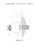 SECUREMENT DEVICE FOR SHUNT CATHETER AND IMPLANTATION METHOD THEREFOR diagram and image