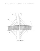 SECUREMENT DEVICE FOR SHUNT CATHETER AND IMPLANTATION METHOD THEREFOR diagram and image