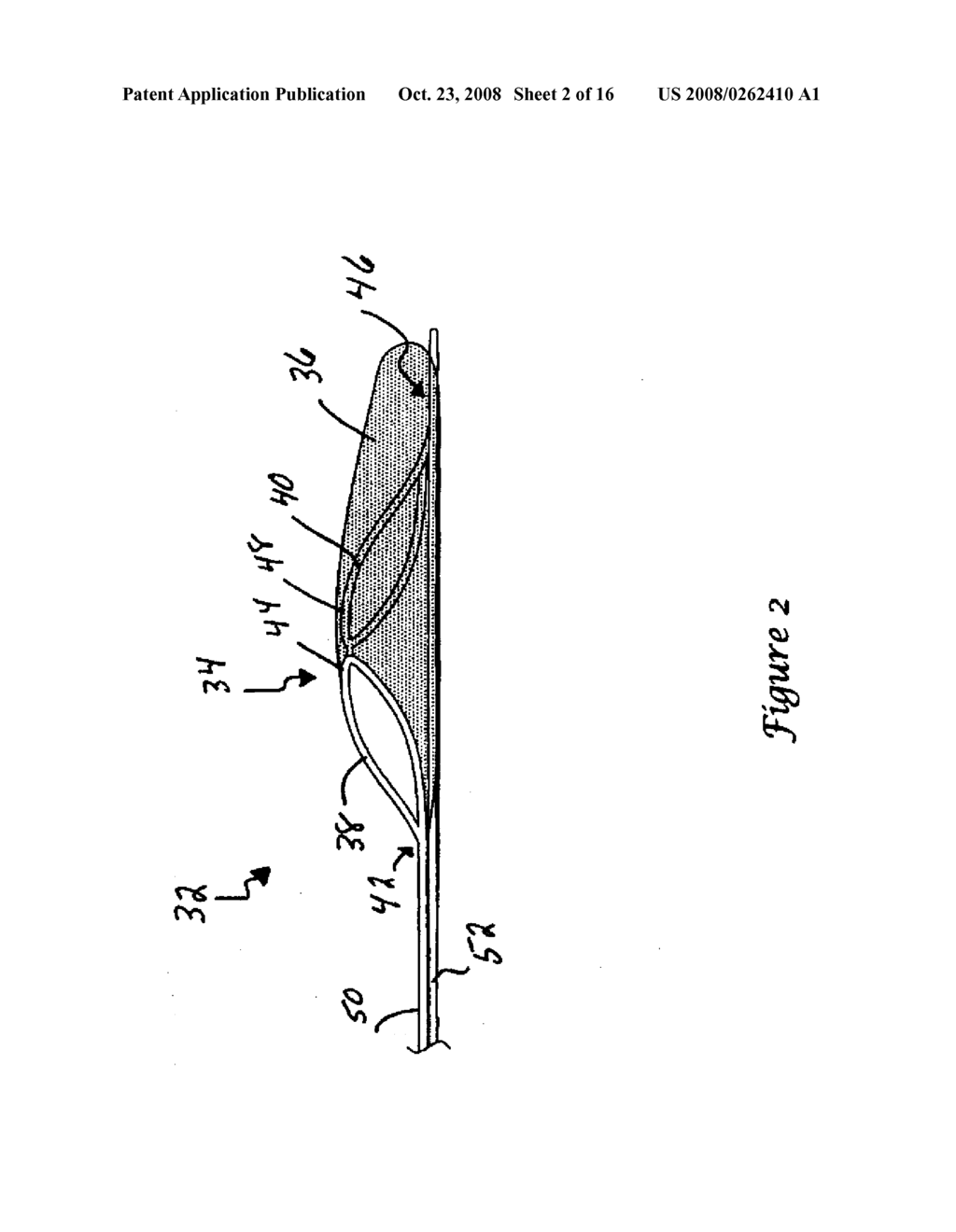 THROMBECTOMY APPARATUS AND METHOD - diagram, schematic, and image 03