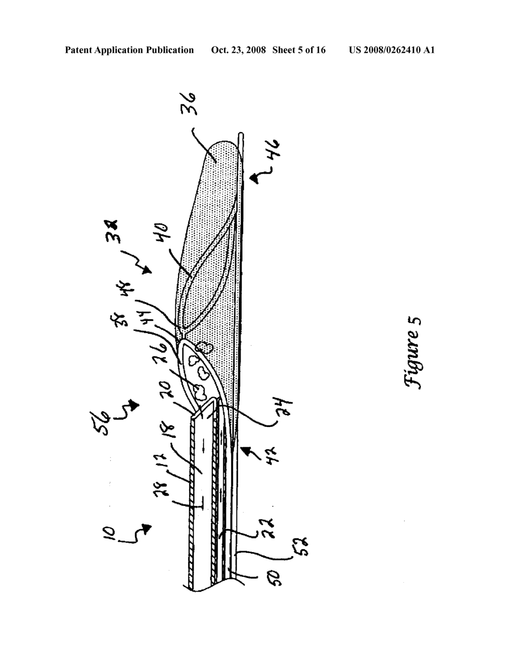 THROMBECTOMY APPARATUS AND METHOD - diagram, schematic, and image 06