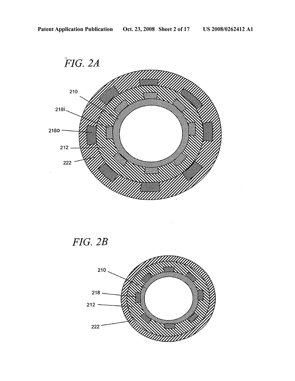 Internal medical devices for delivery of therapeutic agent in conjunction with a source of electrical power - diagram, schematic, and image 03