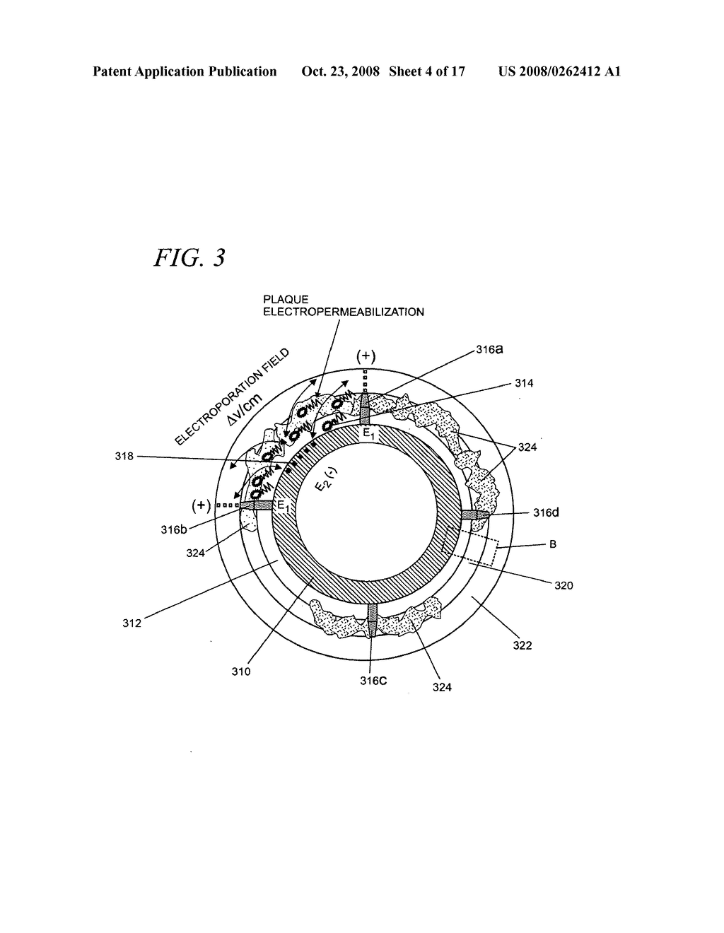 Internal medical devices for delivery of therapeutic agent in conjunction with a source of electrical power - diagram, schematic, and image 05