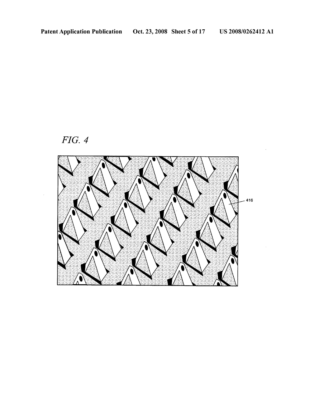 Internal medical devices for delivery of therapeutic agent in conjunction with a source of electrical power - diagram, schematic, and image 06