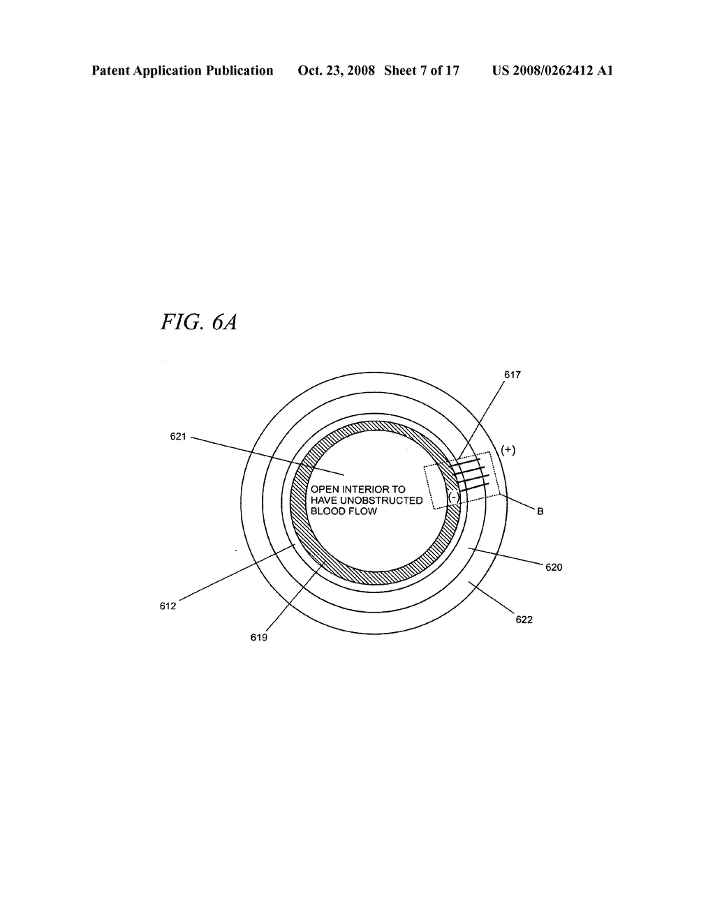 Internal medical devices for delivery of therapeutic agent in conjunction with a source of electrical power - diagram, schematic, and image 08