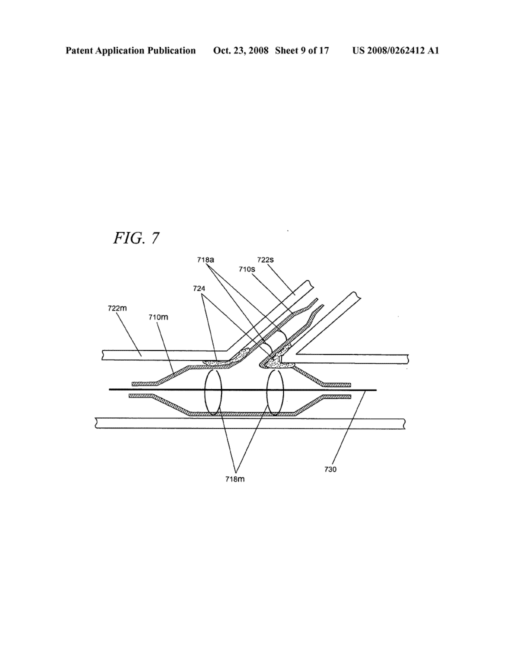 Internal medical devices for delivery of therapeutic agent in conjunction with a source of electrical power - diagram, schematic, and image 10