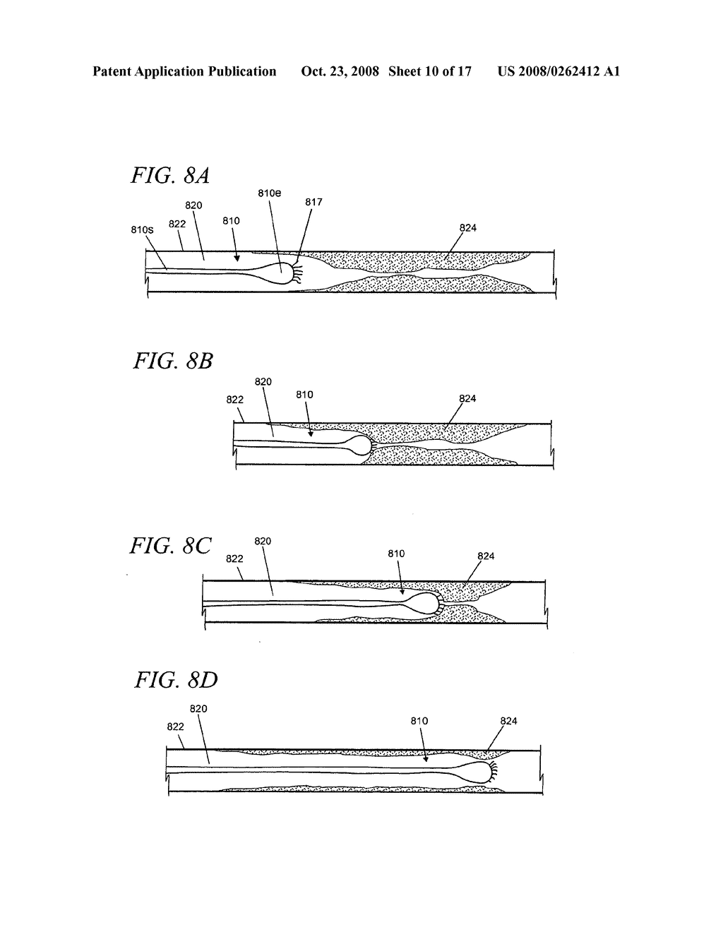 Internal medical devices for delivery of therapeutic agent in conjunction with a source of electrical power - diagram, schematic, and image 11