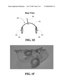 INTRATHECAL INJECTION GUIDE APPARATUS AND METHODS FOR MAKING AND USING SAME diagram and image