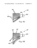 Disposable Absorbent Articles With Zones Comprising Elastomeric Components diagram and image