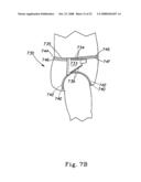 Disposable Absorbent Articles With Zones Comprising Elastomeric Components diagram and image