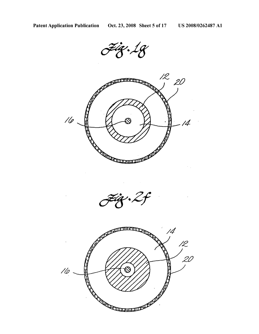 Clot capture coil and method of using same - diagram, schematic, and image 06