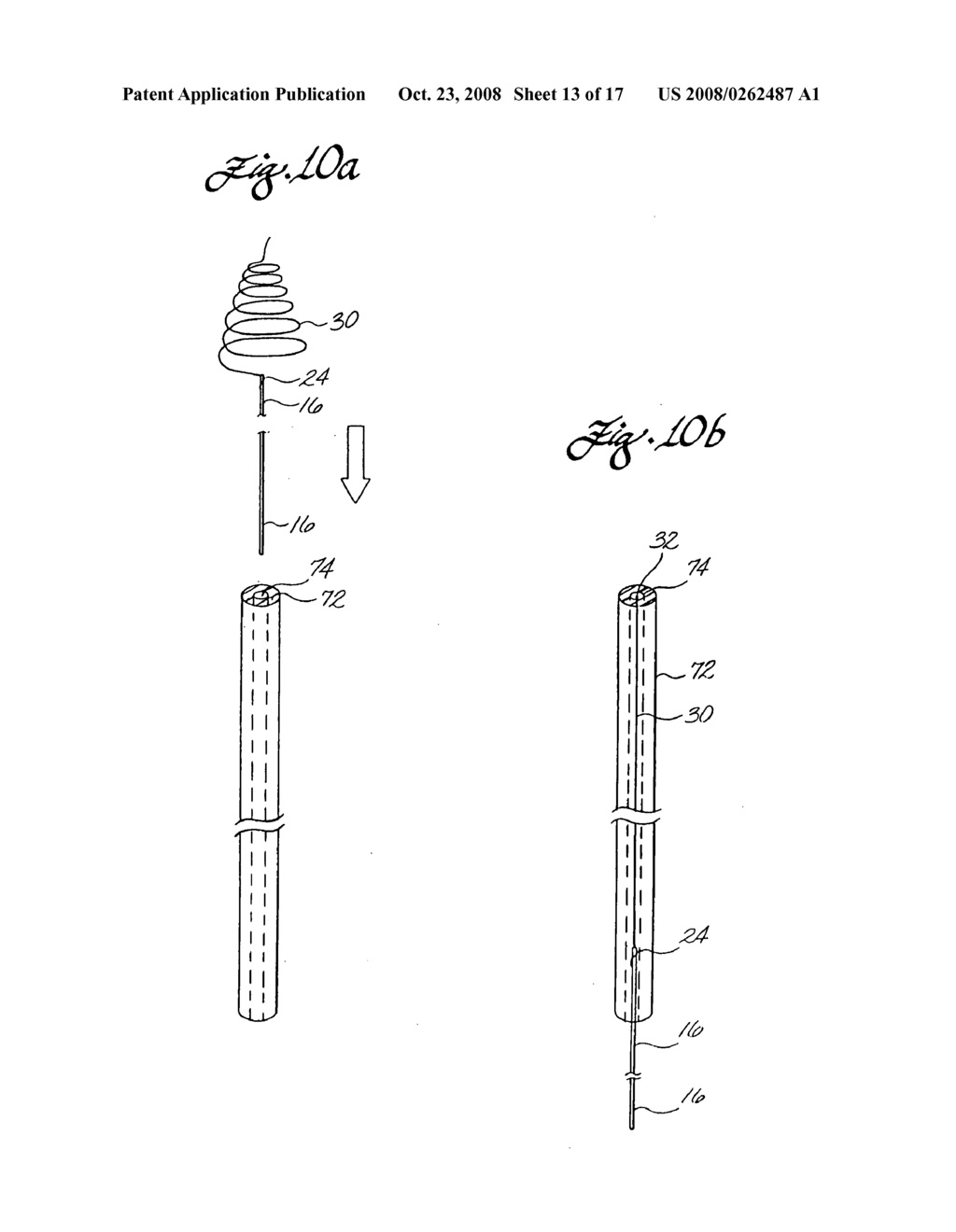 Clot capture coil and method of using same - diagram, schematic, and image 14