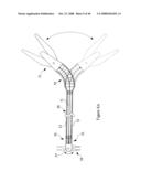 Surgical Instrument diagram and image