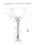 Surgical Instrument diagram and image