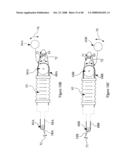 Surgical Instrument diagram and image