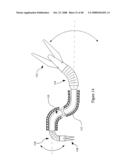 Surgical Instrument diagram and image