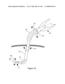 Surgical Instrument diagram and image