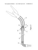 Surgical Instrument diagram and image