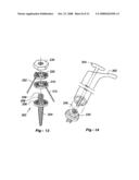 CROSS-COUPLED VERTEBRAL STABILIZERS INCORPORATING SPINAL MOTION RESTRICTION diagram and image