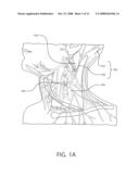 METHODS AND SYSTEMS OF TREATING MEDICATION OVERUSE HEADACHE diagram and image