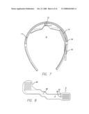 VISUAL PROSTHESIS diagram and image