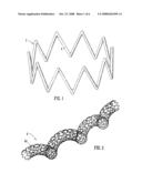 Stent diagram and image