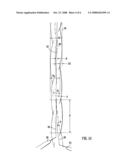 Stent diagram and image