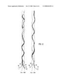 Stent diagram and image