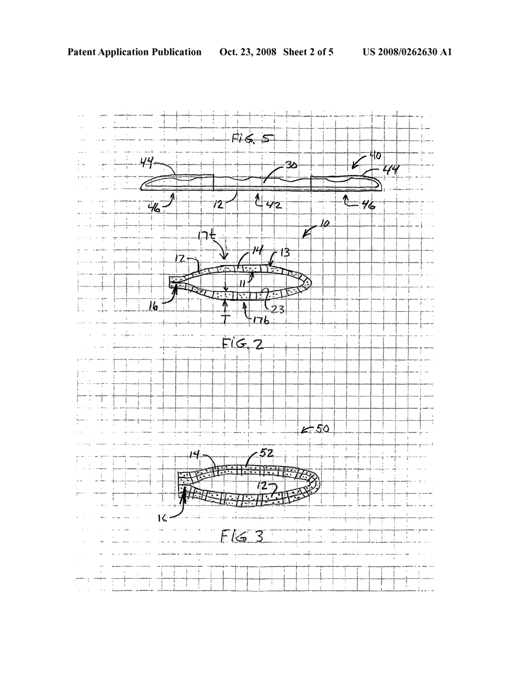 Drug-Impregnated Encasement - diagram, schematic, and image 03