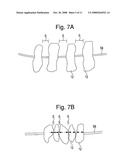 MAGNETIC STONE DEVICE AND METHOD OF MANUFACTURING THE SAME, AND MAGNETIC BEADS AND METHOD OF MANUFACTURING THE SAME diagram and image