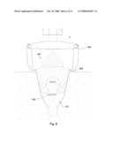 Retention for an Insert diagram and image