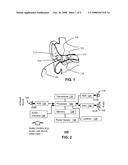 Method and Device for Sound Detection and Audio Control diagram and image