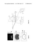 System and Method for Segmenting a Region in a Medical Image diagram and image