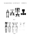 AUTOMATIC PARTITIONING AND RECOGNITION OF HUMAN BODY REGIONS FROM AN ARBITRARY SCAN COVERAGE IMAGE diagram and image