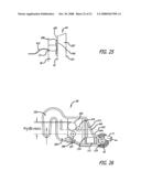 Heat exchanger for high flow rate infusion diagram and image