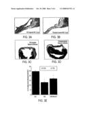 Cardiac Stem Cells diagram and image