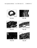 Cardiac Stem Cells diagram and image