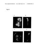 Compositions and Methods for Delivery of Antitumor Agents diagram and image