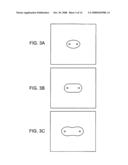 ELECTROPORATION TO INTERRUPT BLOOD FLOW diagram and image