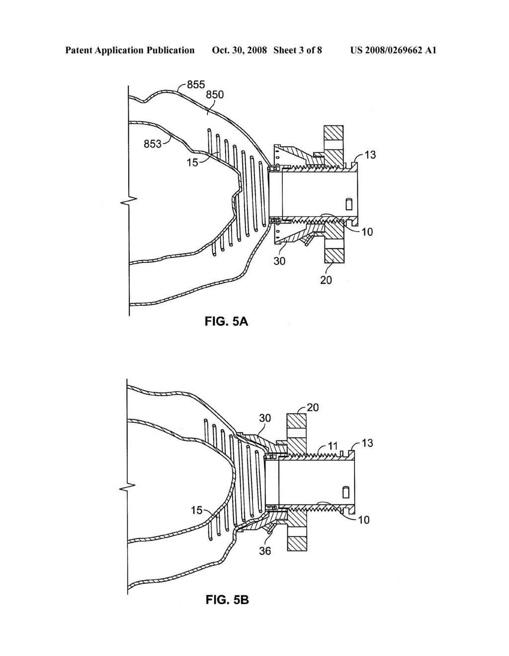 CONDUIT DEVICE AND SYSTEM FOR IMPLANTING A CONDUIT DEVICE IN A TISSUE WALL - diagram, schematic, and image 04