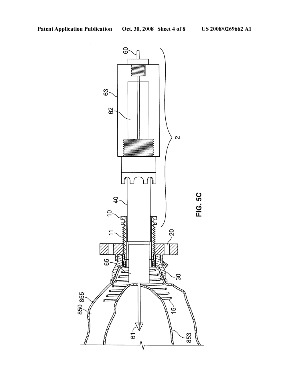 CONDUIT DEVICE AND SYSTEM FOR IMPLANTING A CONDUIT DEVICE IN A TISSUE WALL - diagram, schematic, and image 05