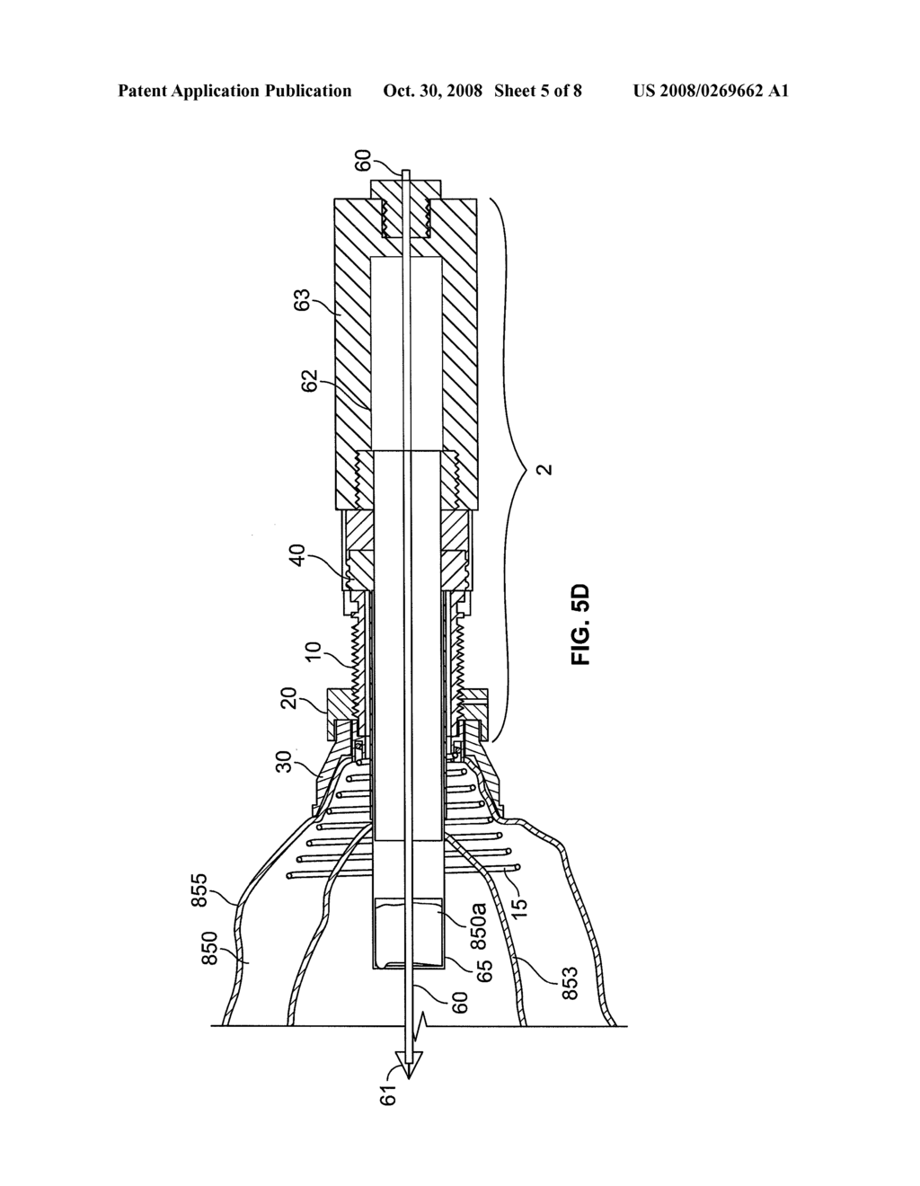 CONDUIT DEVICE AND SYSTEM FOR IMPLANTING A CONDUIT DEVICE IN A TISSUE WALL - diagram, schematic, and image 06