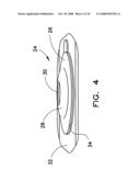 Ostomy pouch diagram and image