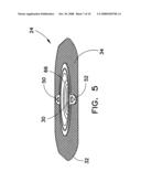 Ostomy pouch diagram and image