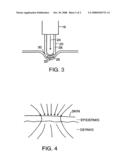 METHOD AND APPARATUS FOR TREATING WRINKLES IN SKIN USING RADIATION diagram and image