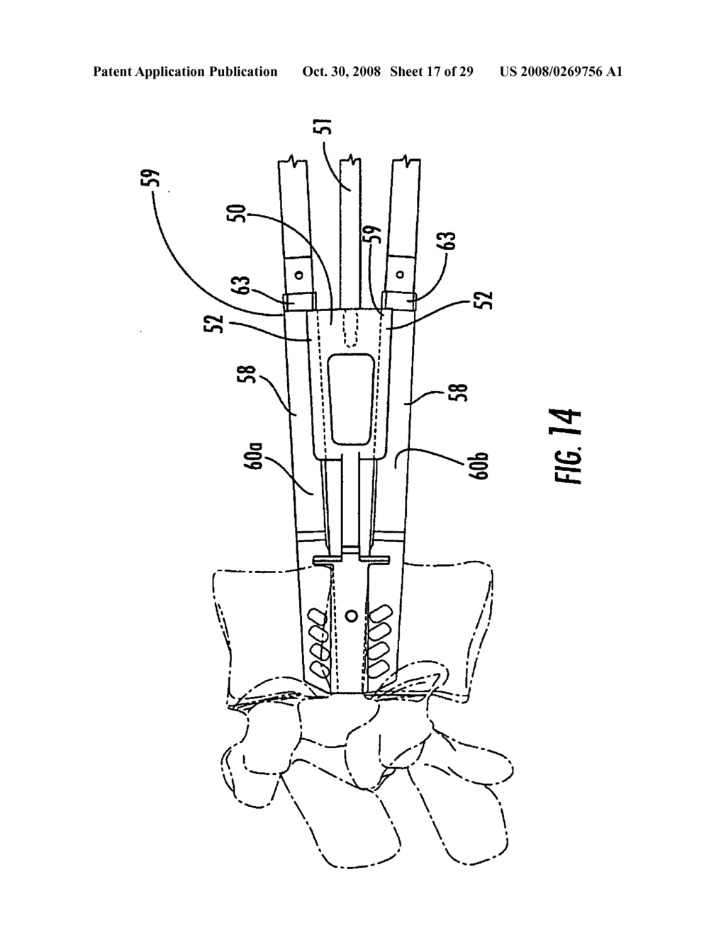 SURGICAL INSTRUMENTS FOR SPINAL DISC IMPLANTS AND RELATED METHODS - diagram, schematic, and image 18