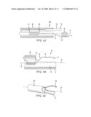 Intracorporeal Grasping Device diagram and image