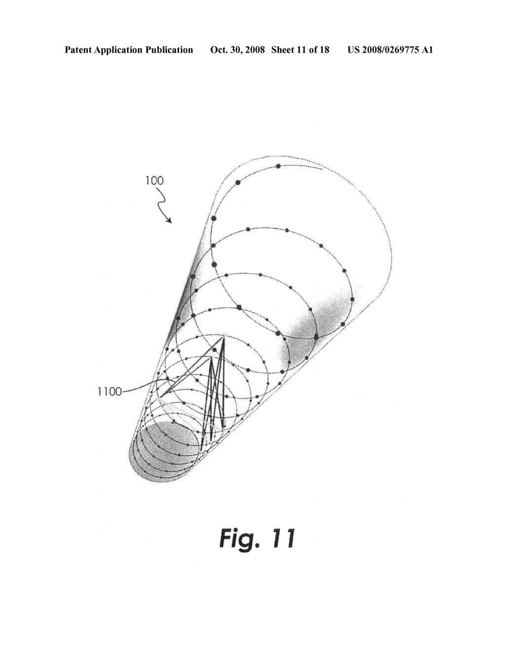 Method and apparatus for providing medical treatment using visualization components of audio spectrum signals - diagram, schematic, and image 12