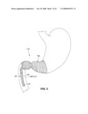 SATIATION DEVICES AND METHODS diagram and image