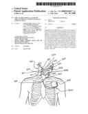 IMPLANTABLE MEDICAL LEAD FOR IMPLANTATION IN A PATIENT, SUCH AS A PATIENT S NECK diagram and image