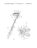 IMPLANTABLE MEDICAL LEAD FOR IMPLANTATION IN A PATIENT, SUCH AS A PATIENT S NECK diagram and image